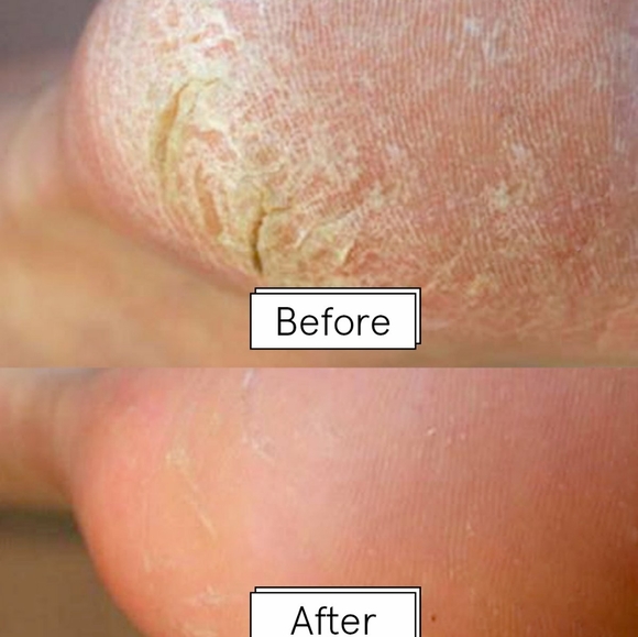 🅽🆆🆃-Dr. Pedicure Foot Mask | Fabfitfun - Picture 7 of 13